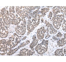 Immunohistochemistry - PTGER3 Antibody from Signalway Antibody (43458) - Antibodies.com