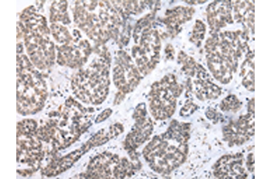 Immunohistochemistry - PTGER3 Antibody from Signalway Antibody (43458) - Antibodies.com
