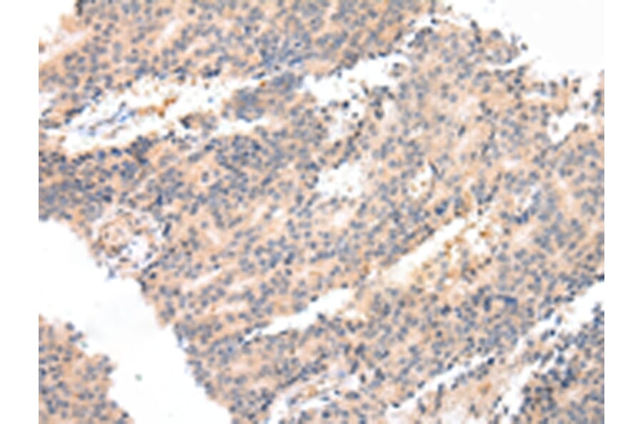 Immunohistochemistry - PTGER3 Antibody from Signalway Antibody (43458) - Antibodies.com