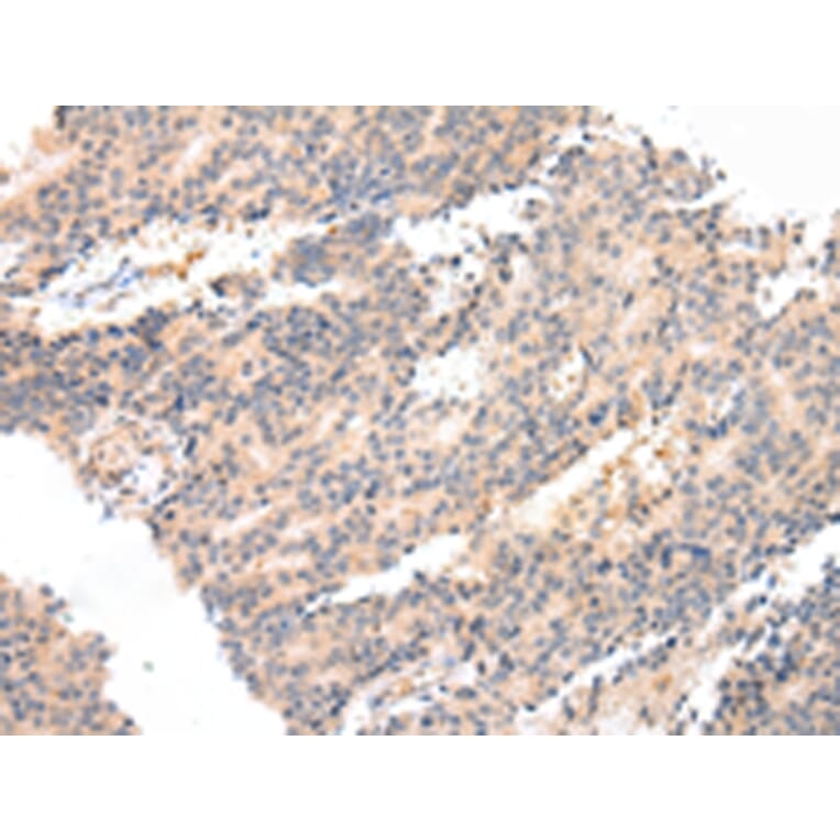 Immunohistochemistry - PTGER3 Antibody from Signalway Antibody (43458) - Antibodies.com