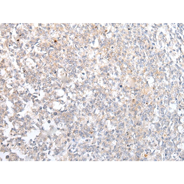 Immunohistochemistry - ABCB10 Antibody from Signalway Antibody (43466) - Antibodies.com