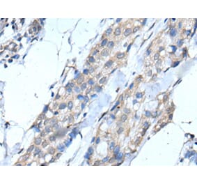 SCNN1G Antibody from Signalway Antibody (43516) - Antibodies.com