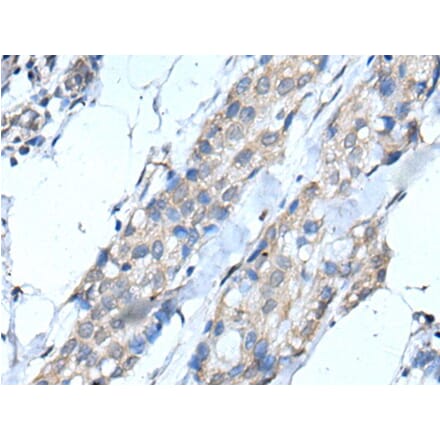 SCNN1G Antibody from Signalway Antibody (43516) - Antibodies.com