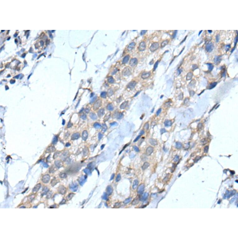 SCNN1G Antibody from Signalway Antibody (43516) - Antibodies.com