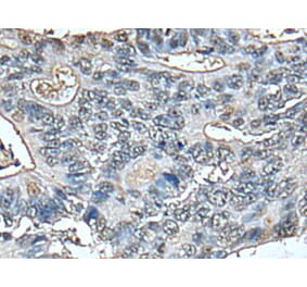 STRADA Antibody from Signalway Antibody (43521) - Antibodies.com