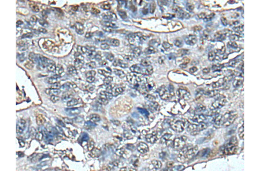 STRADA Antibody from Signalway Antibody (43521) - Antibodies.com
