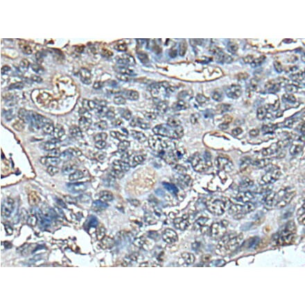 STRADA Antibody from Signalway Antibody (43521) - Antibodies.com