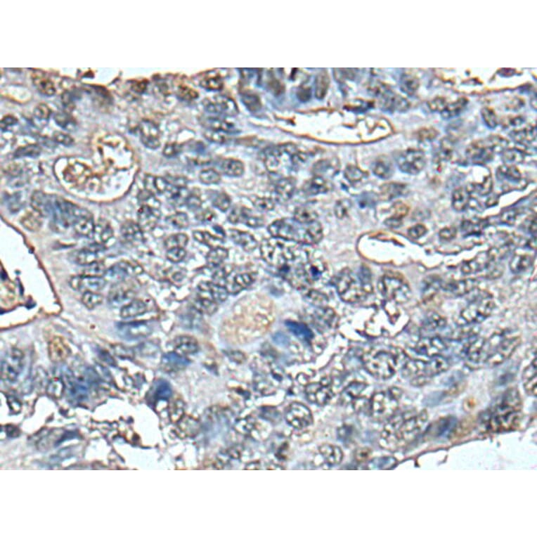 STRADA Antibody from Signalway Antibody (43521) - Antibodies.com