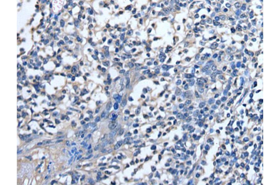 STRADA Antibody from Signalway Antibody (43521) - Antibodies.com