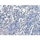 STRADA Antibody from Signalway Antibody (43521) - Antibodies.com