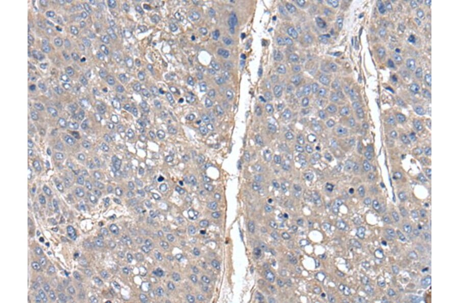 THAP10 Antibody from Signalway Antibody (43540) - Antibodies.com