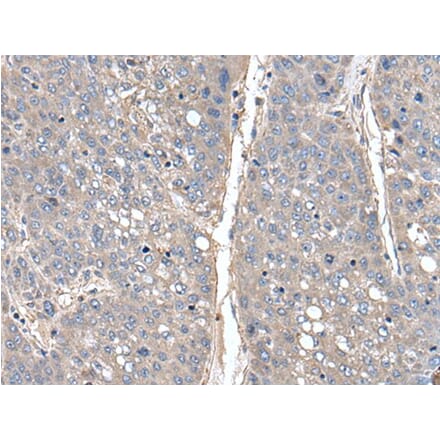 THAP10 Antibody from Signalway Antibody (43540) - Antibodies.com