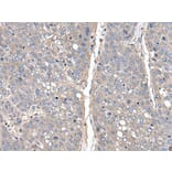 THAP10 Antibody from Signalway Antibody (43540) - Antibodies.com