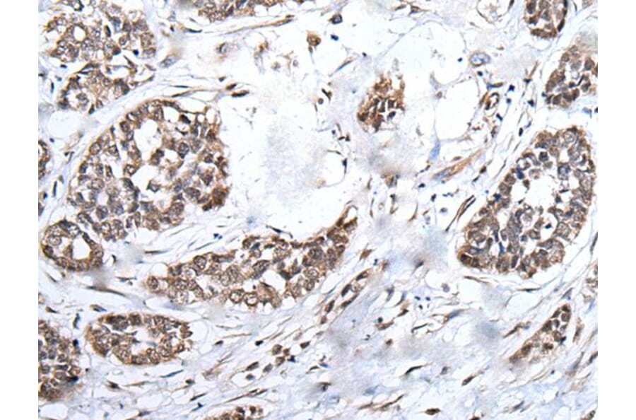 BRMS1L Antibody from Signalway Antibody (43546) - Antibodies.com