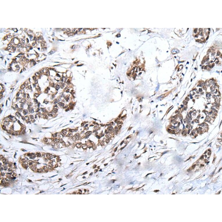 BRMS1L Antibody from Signalway Antibody (43546) - Antibodies.com