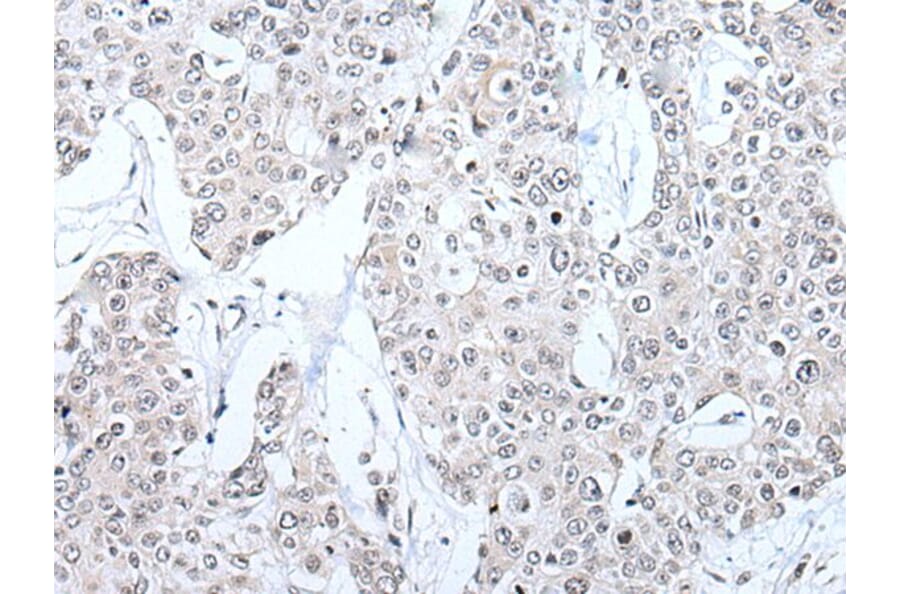 BRMS1L Antibody from Signalway Antibody (43546) - Antibodies.com