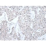 BRMS1L Antibody from Signalway Antibody (43546) - Antibodies.com