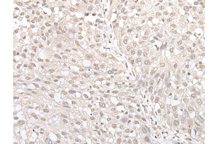 MIF4GD Antibody from Signalway Antibody (43560) - Antibodies.com