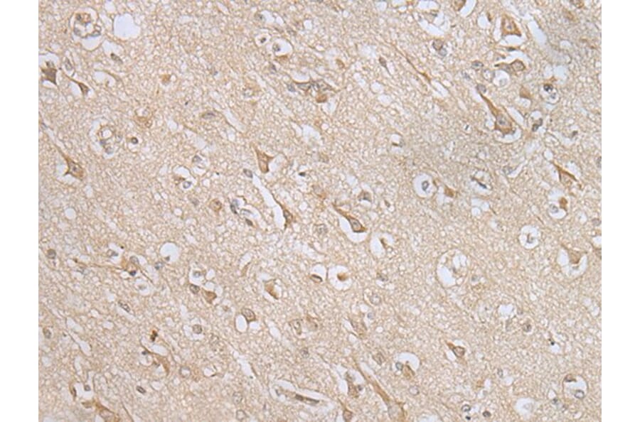 MIF4GD Antibody from Signalway Antibody (43560) - Antibodies.com