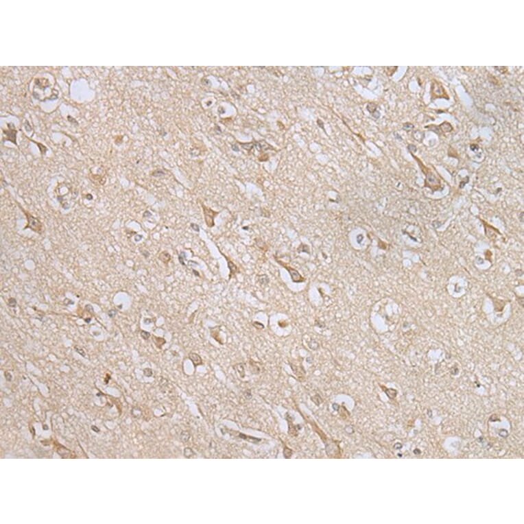 MIF4GD Antibody from Signalway Antibody (43560) - Antibodies.com