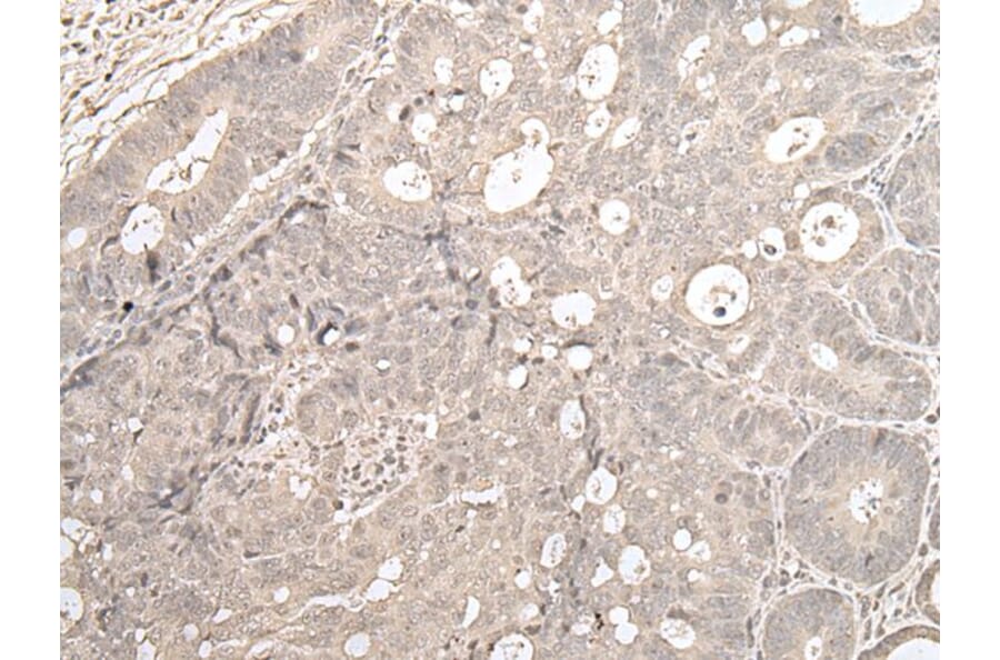 ZNF138 Antibody from Signalway Antibody (43568) - Antibodies.com