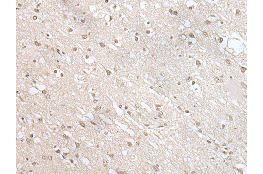 ZNF138 Antibody from Signalway Antibody (43568) - Antibodies.com