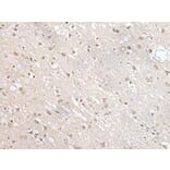 ZNF138 Antibody from Signalway Antibody (43568) - Antibodies.com