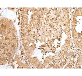 ZNF213 Antibody from Signalway Antibody (43574) - Antibodies.com
