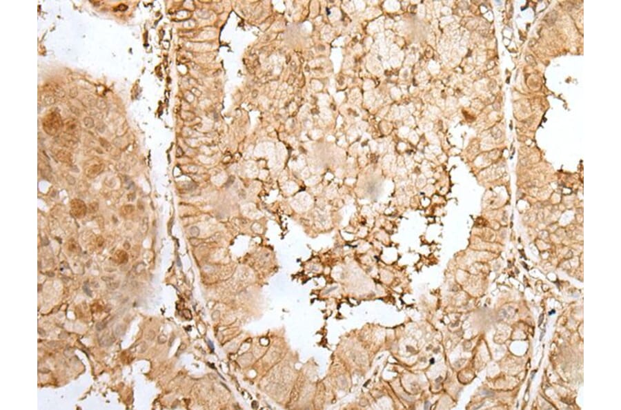 ZNF213 Antibody from Signalway Antibody (43574) - Antibodies.com