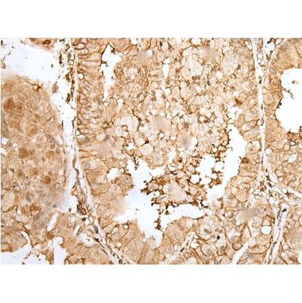 ZNF213 Antibody from Signalway Antibody (43574) - Antibodies.com