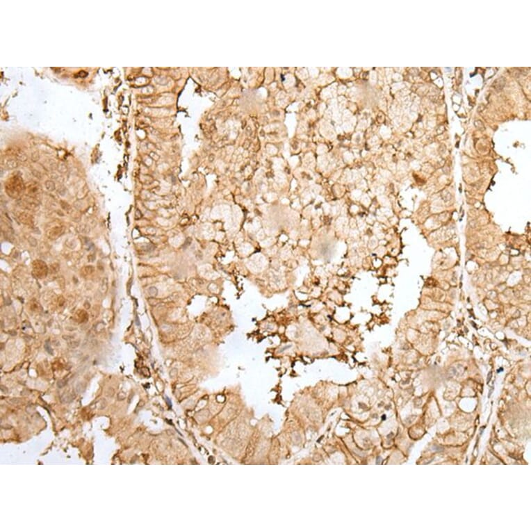 ZNF213 Antibody from Signalway Antibody (43574) - Antibodies.com
