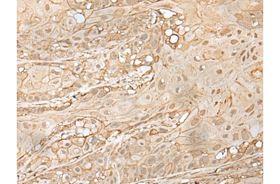 ZNF213 Antibody from Signalway Antibody (43574) - Antibodies.com