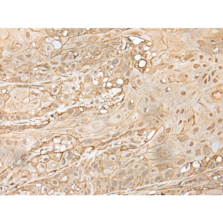 ZNF213 Antibody from Signalway Antibody (43574) - Antibodies.com