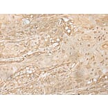 ZNF213 Antibody from Signalway Antibody (43574) - Antibodies.com