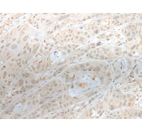 ZBTB18 Antibody from Signalway Antibody (43575) - Antibodies.com