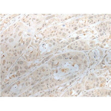 ZBTB18 Antibody from Signalway Antibody (43575) - Antibodies.com