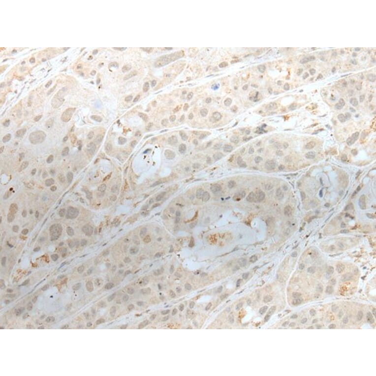 ZBTB18 Antibody from Signalway Antibody (43575) - Antibodies.com