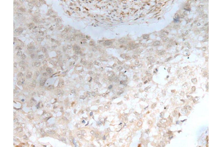 ZBTB18 Antibody from Signalway Antibody (43575) - Antibodies.com