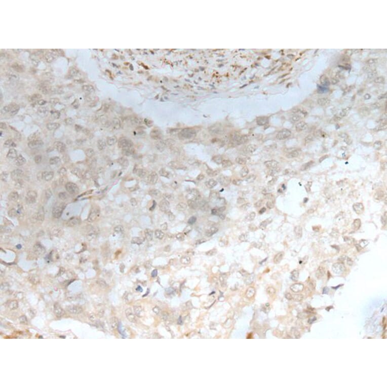 ZBTB18 Antibody from Signalway Antibody (43575) - Antibodies.com