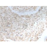 ZBTB18 Antibody from Signalway Antibody (43575) - Antibodies.com