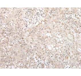 ZNF263 Antibody from Signalway Antibody (43576) - Antibodies.com