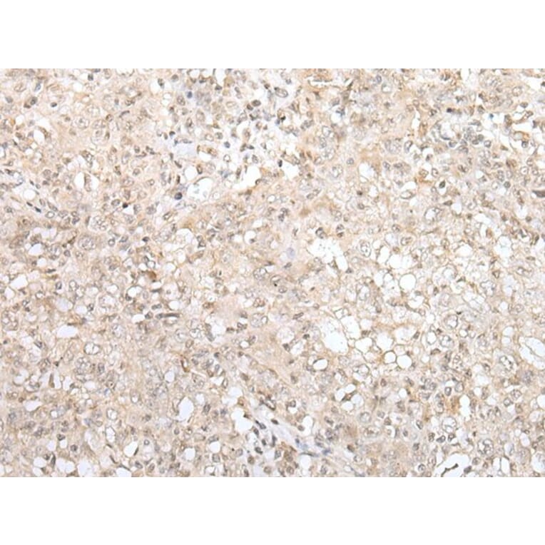 ZNF263 Antibody from Signalway Antibody (43576) - Antibodies.com