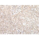 ZNF263 Antibody from Signalway Antibody (43576) - Antibodies.com