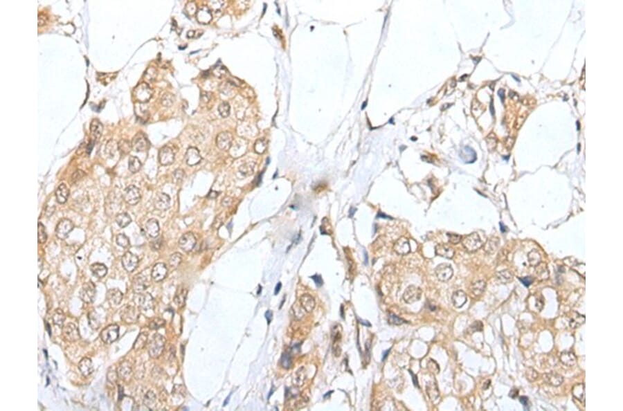 ZNF263 Antibody from Signalway Antibody (43576) - Antibodies.com