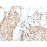 ZNF263 Antibody from Signalway Antibody (43576) - Antibodies.com