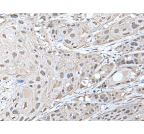 ZNF277 Antibody from Signalway Antibody (43577) - Antibodies.com