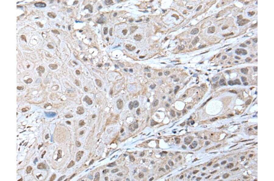 ZNF277 Antibody from Signalway Antibody (43577) - Antibodies.com