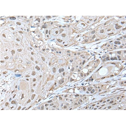 ZNF277 Antibody from Signalway Antibody (43577) - Antibodies.com