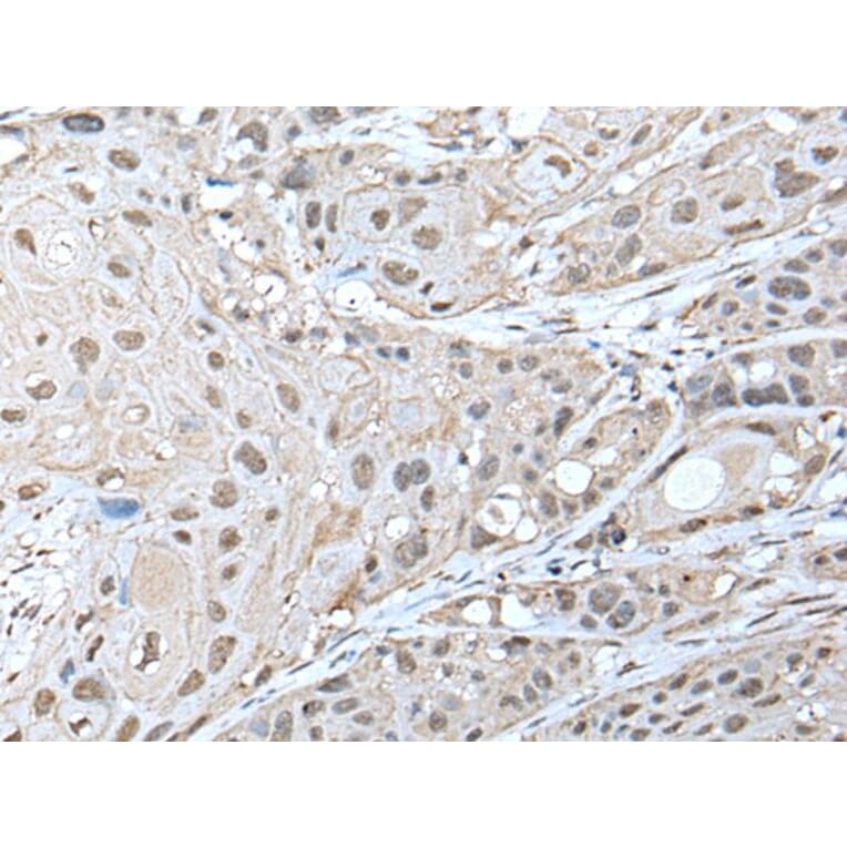 ZNF277 Antibody from Signalway Antibody (43577) - Antibodies.com