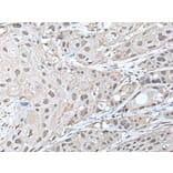ZNF277 Antibody from Signalway Antibody (43577) - Antibodies.com